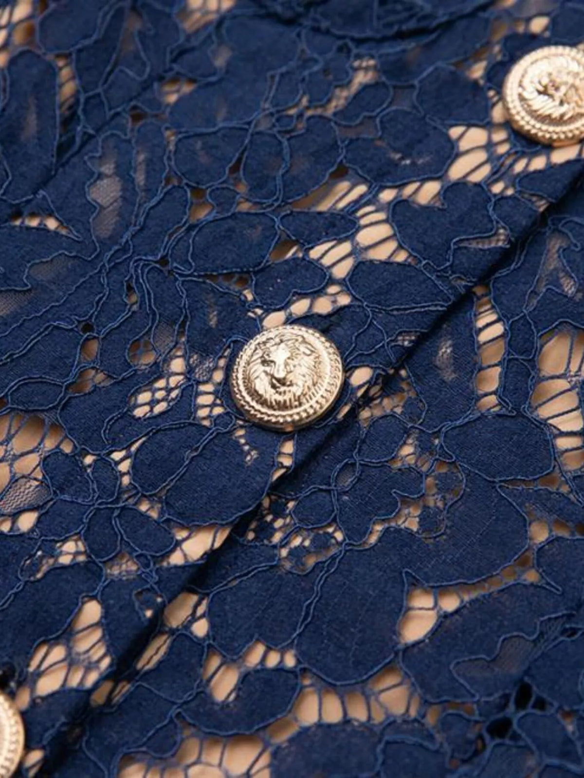 lace button down midi dress shoulder detail