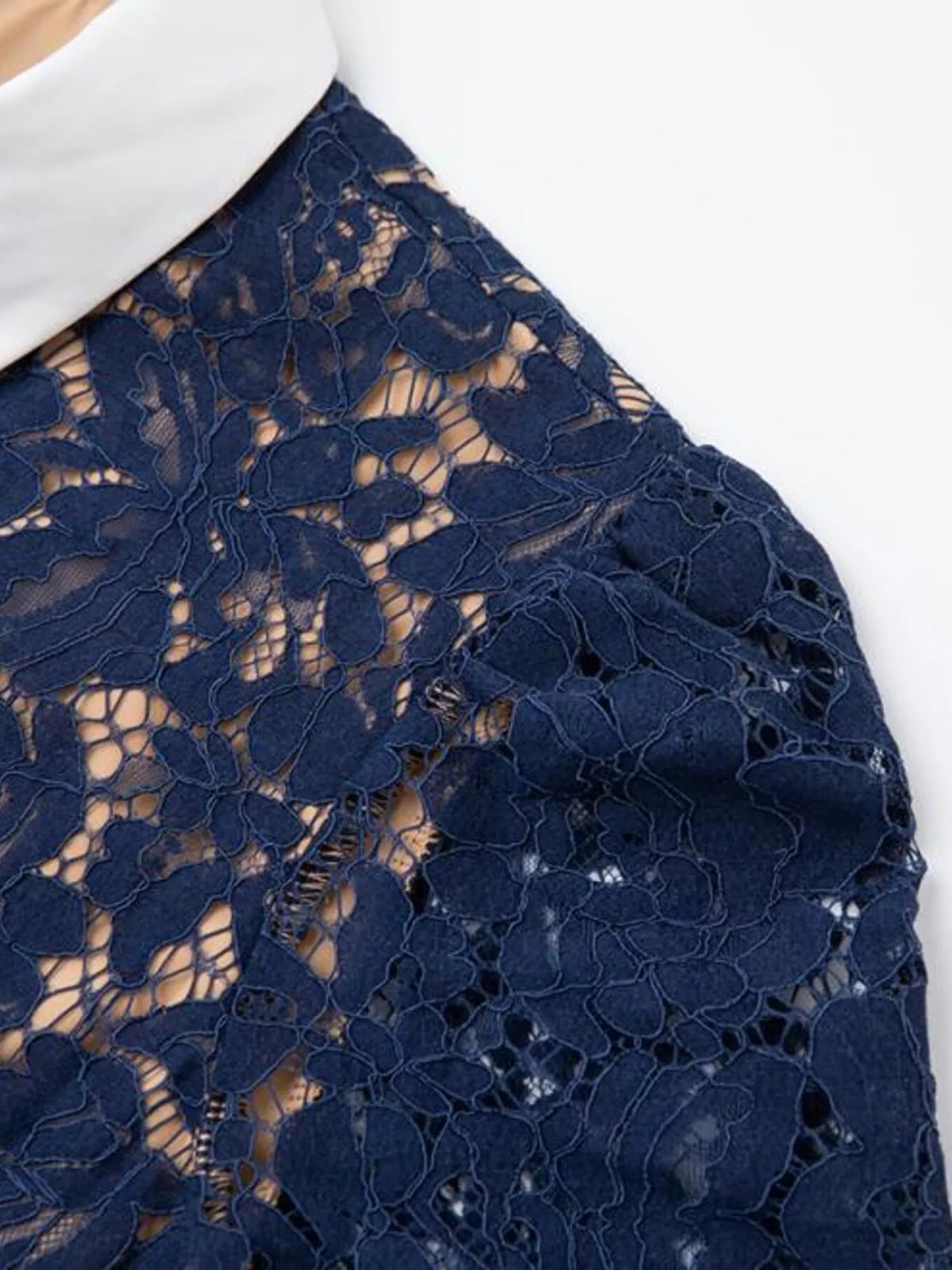 lace button down midi dress hemline detail